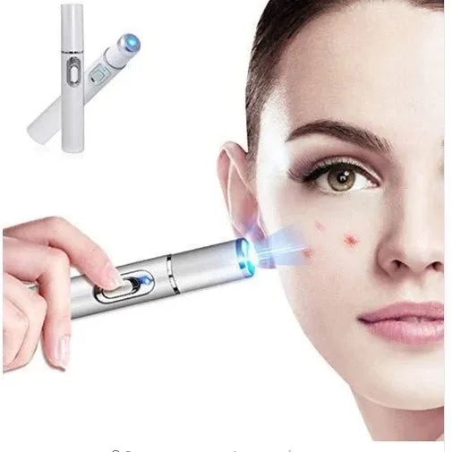 Caneta Laser Removedora de Varizes + Frete Grátis + Bônus + Descontos
