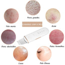 Peeling Facial UltraSkin com Limpeza Profunda e Rejuvenescimento Imediato