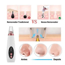 Removedor de Cravos CleanCare com Sucção Profunda