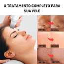 Peeling Facial UltraSkin com Limpeza Profunda e Rejuvenescimento Imediato