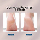Lixa Elétrica Para os Pés SoftFoot com Dupla Velocidade
